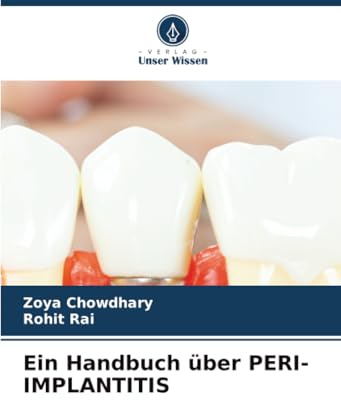 Ein Handbuch über PERI-IMPLANTITIS: DE