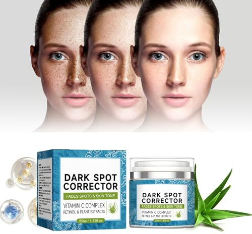 Tkekruh Dark Spot 55ml Rimozione Macchie Scure per Viso, Schiarisci la Pelle, Crema Correttiva Schiarente Schiarente, per Il Viso per Uomini e Donne