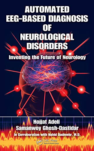 Automated EEG-Based Diagnosis of Neurological Disorders: Inventing the Future of Neurology (English Edition)