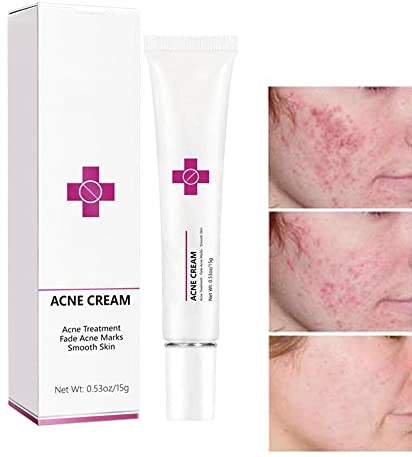 Acne Cream Pimple Cream for Face, Oil Control Pimple Remover Cream Get Rid of Pimples Fast,for Oily and Acne Prone Skin, Cruelty Free, Crema para espinillas en la cara