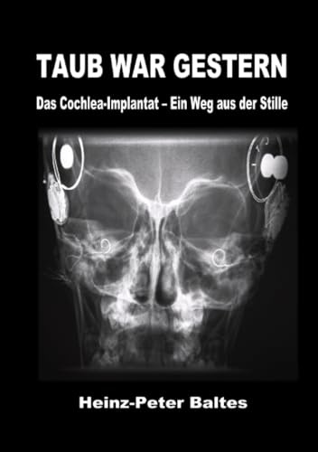 Taub war gestern: Das Cochlea-Implantat - Ein Weg aus der Stille: Das Cochlea-Implantat - Ein Weg aus der Stille.DE