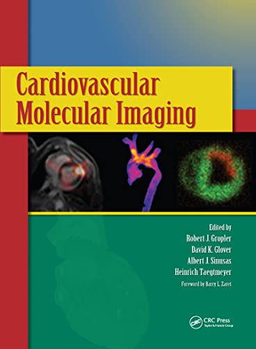 Cardiovascular Molecular Imaging