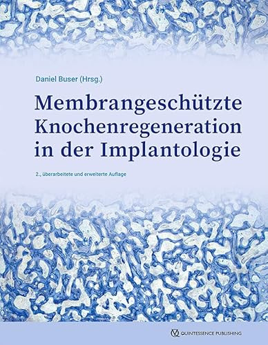 GBR-Technik in der Implantologie: Seit 35 Jahren Fortschritt und neue Anwendungen