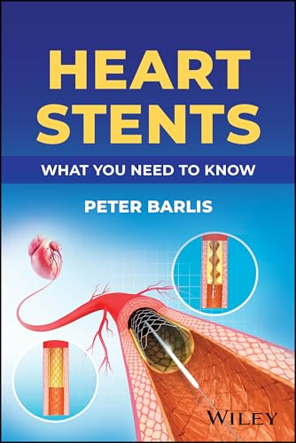 Heart Stents: What You Need to Know