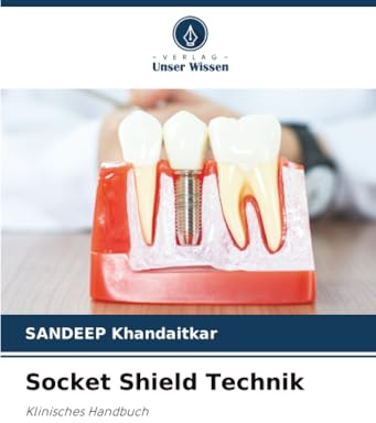 Socket Shield Technik: Klinisches Handbuch