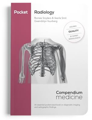 Pocket Radiology: An essential pocket-sized book on diagnostic imaging and radiographic findings. (Pocket Collection)