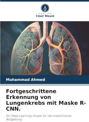 Fortgeschrittene Erkennung von Lungenkrebs mit Maske R-CNN.: Ein Deep Learning-Ansatz für die medizinische Bildgebung
