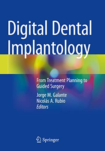 Digital Dental Implantology: From Treatment Planning to Guided Surgery