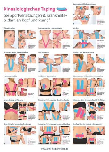 Poster Kinesiologisches Taping (3 Poster im Set): bei Sportverletzungen und Krankheitsbildern