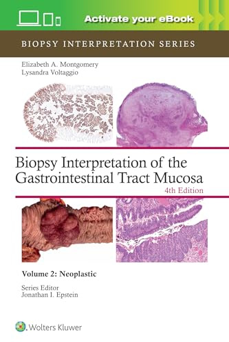 Biopsy Interpretation of the Gastrointestinal Tract Mucosa Volume 2: Neoplastic: Print + eBook with Multimedia (Biopsy Interpretation Series)