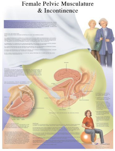 3B Scientific - Tabla De Incontinencia Urinaria Femenina, Laminado, 1