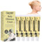 Crème Chinoise Naturelle, Crème Pour Le Corps, Crème Pour Le Visage, Crème Naturelle À Base De Plantes, 15g*5