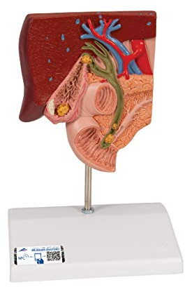 3B Scientific® Gallenstein-Modell – Menschliche Gallenblasenanatomie mit verschiedenen Gallensteinbildungen, Langlebiges PVC + Smart Anatomy App (5 Jahre Garantie)