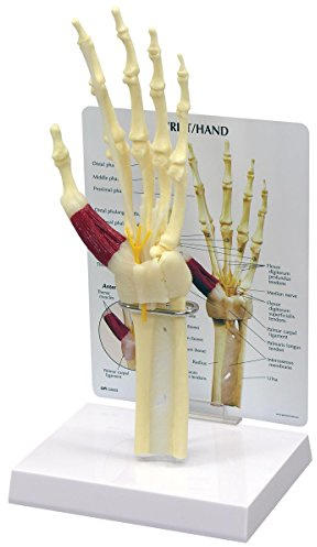 GPI Anatomicals 1920 Hand ModellKarpaltunnelsyndrom