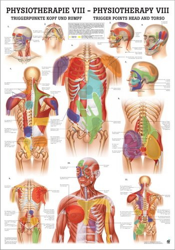 Ruediger Anatomie PHYS VIII LAM Triggerpunkte Kopf und Rumpf Tafel, 50 cm x 70 cm, laminiert