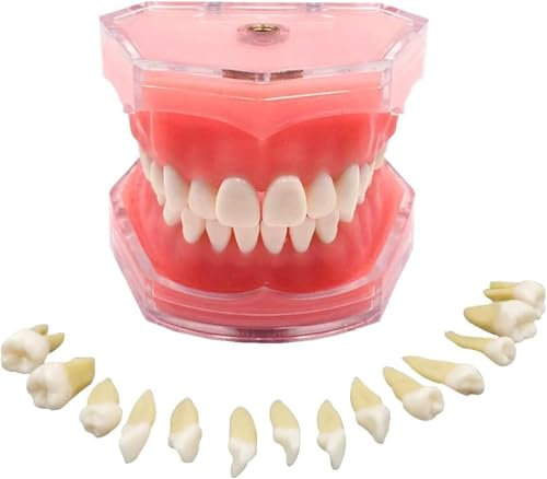 CHROX Modèle en PVC De Dents Amovibles, Modèle De Simulation, Restauration Dentaire D'implants De Pont, Modèle Pédagogique pour La Pratique Pédagogique avec Tournevis