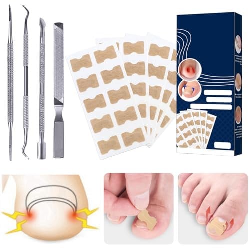 50PCS Ingrown Toenail Correction Patch Ingrown Toenail Sticker Patch Nail Correction Sticker with 4PCS Nail Correction Tool,Glue-Free Toenail Correction Patch for Ingrown Toenails Foot Care Treatment