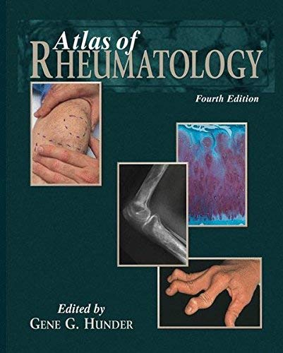 [(Atlas of Rheumatology)] [Author: Gene G. Hunder] published on (April, 2006)