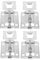 Housoutil Hood Lift Support Kit Range Hood Supplies Metal Hooks Simple Installation for Uk Kitchen