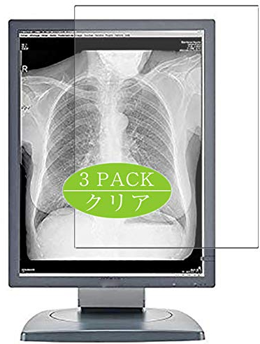 Vaxson 3 Stück Schutzfolie kompatibel mit Barco Coronis MDCG-3120 3MP 21 Display Monitor Display folie folien Displayschutzfolie ( nicht Panzer Schutz Glas folie SchutzGlas nicht PanzerGlas ) Update