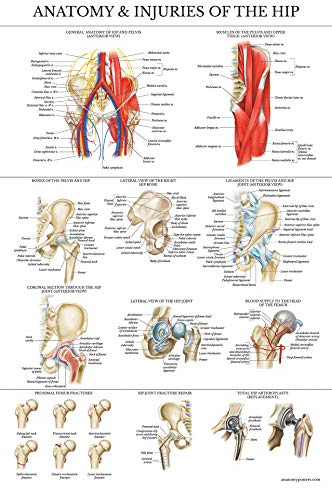Palace Learning Laminiertes Poster Anatomie und Verletzungen der Hüfte, Hüftgelenk, 45,7 x 61 cm