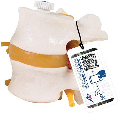 3B Scientific Menschliche Anatomie - 2 Lendenwirbel mit Bandscheibenvorfall, elastisch montiert + kostenlose Anatomie App - 3B Smart Anatomy