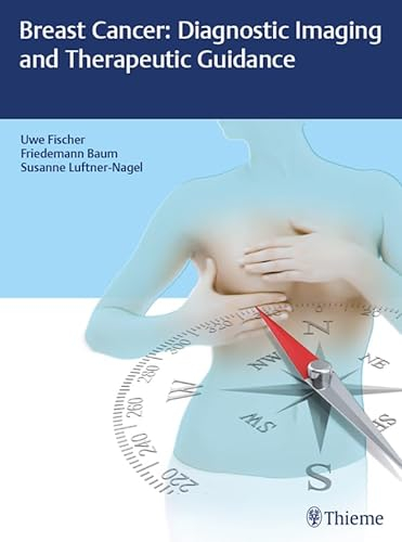 Breast Cancer: Diagnostic Imaging and Therapeutic Guidance (English Edition)
