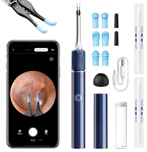 Qimic Ear Camera with Tweezers - Ear Cleaner with Camera,1080P HD Earwax Removal Tool with Light, IP67 Ear Cleaning Kit with 6 Ear Spoon, Ear Camera Otoscope for iPhone, Android