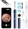 Qimic Ear Camera with Tweezers - Ear Cleaner with Camera,1080P HD Earwax Removal Tool with Light, IP67 Ear Cleaning Kit with 6 Ear Spoon, Ear Camera Otoscope for iPhone, Android
