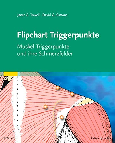 Flipchart Triggerpunkte: Muskel-Triggerpunkte und ihre Schmerzfelder
