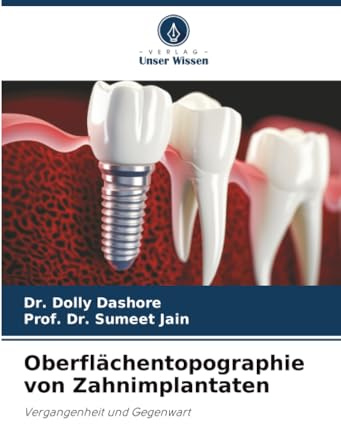 Oberflächentopographie von Zahnimplantaten: Vergangenheit und Gegenwart