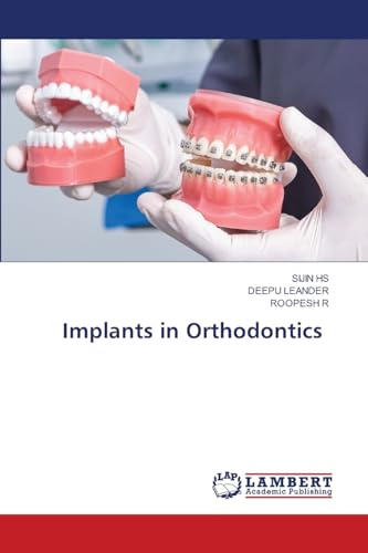 Implants in Orthodontics: DE