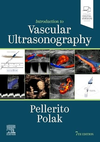 Introduction to Vascular Ultrasonography: Expert Consult - Online and Print