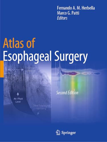 Atlas of Esophageal Surgery