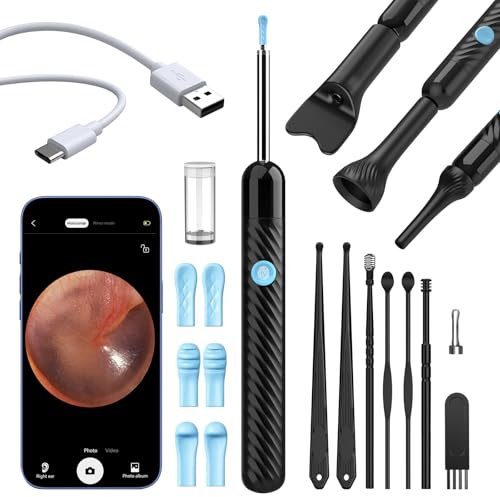 VITCOCO Ear Wax Removal Tool Camera, Ear Cleaner with 1080P Camera, Ear Cleaning Kit with Three Inspection Kits, Otoscope with Lights for Ear,Nose,Tongue Examinations