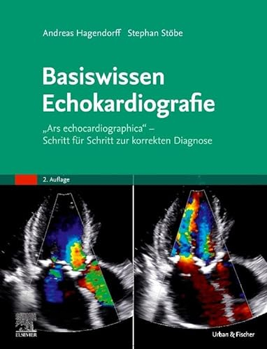 Basiswissen Echokardiografie: Ars echocardiographica - Schritt für Schritt zur korrekten Diagnose