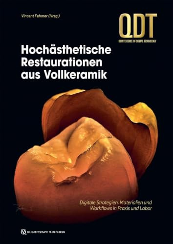 Hochästhetische Restaurationen aus Vollkeramik: Digitale Strategien, Materialien und Workflows in Praxis und Labor (QDT Yearbook)