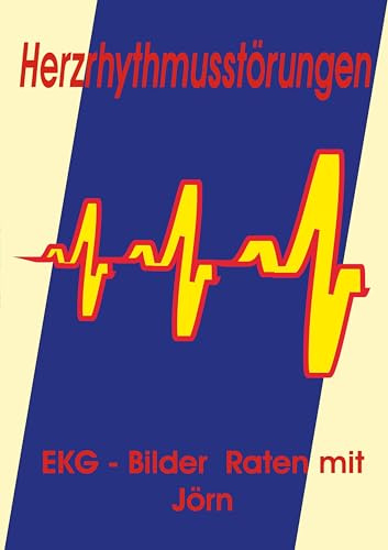 Herzrhythmusstörungen: EKG - Bilder Raten mit Jörn