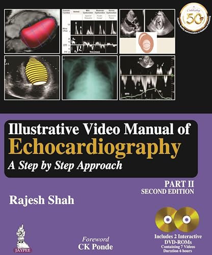 Illustrative Video Manual of Echocardiography: A Step by Step Approach: A Step by Step Approach - Part 2
