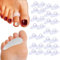 Skeerthy 20 Pieces Gel Hammer Toe Crest Cushions, Right/Left Hammertoe Gel Support Pads, Toe Separators for Overlapping Toes - Claw Toe Pads Reduces Toe & Foot Discomfort