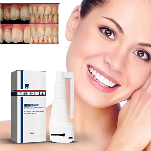 Spray dentale dissolvente senza calcoli, Spray rinfrescante per la bocca, Detergente per denti per rimuovere il tartaro, Dentifricio intensivo per la rimozione delle macchie (1 pz)