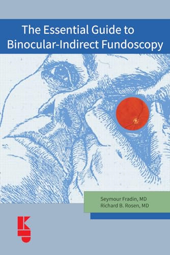 The Essential Guide Plus to Binocular-Indirect Fundoscopy