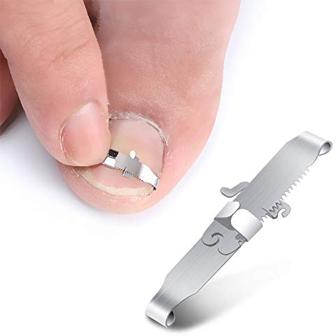 BEZOX 2Pcs Eingewachsene Zehennagel-Werkzeuge, eingewachsene Nagel-Korrekturschnalle und Zehennagel-Heber für eingewachsene Nägel & Paronychie-Behandlung-Chirurgischer Edelstahl (Größe: 44-47)