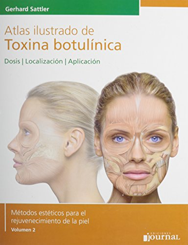 Atlas ilustrado de toxina botulínica (Spanish Edition)