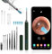 Ear Wax Removal,Ear Wax Cleaner with Camera,Earwax Removal Tool, with 8 Ears, Earwax Cleaning kit 1080P HD Otoscope - Ear Camera with 6 Ear Scoops - Otoscope Ear Pick for iOS and Android (Blue)