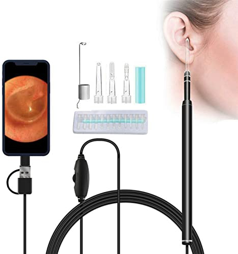 SANON Otoscope Oreille, Endoscope Oreille HD Visuelle Caméra avec 6 LED Lumière Gradable, Adultes Enfants Animaux Nettoyage Oreille Kit pour Android, Tablette et PC
