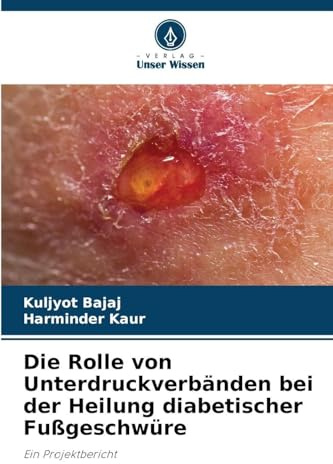 Die Rolle von Unterdruckverbänden bei der Heilung diabetischer Fußgeschwüre: Ein Projektbericht