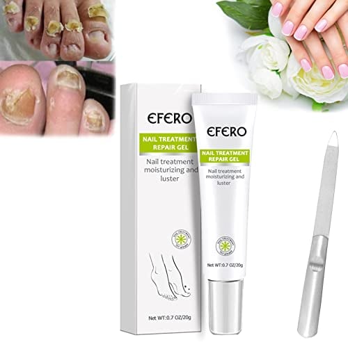Efero - Gel de reparación de uñas, tratamiento de hongos en uñas, crema de uñas, para manos o pies, incluye limas de uñas (1 set)