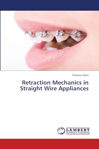 Retraction Mechanics in Straight Wire Appliances: DE