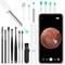 ACWOO Ear Wax Removal Kit, Ear Camera 1296P FHD Wireless Ear Wax Cleaner, Visual Ear Otoscope Ear Cleaner, Ear Camera with 6 LED Light, Ear Wax Removal, Ear Cleaning Kit for iPhone, iPad, Android